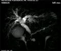 MRCP